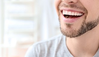 A man in a gray shirt smiling after getting dental bonding in Tyler