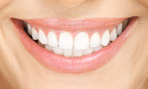 Smiling teeth at Tyler, TX dentist