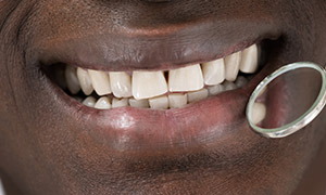 Smiling teeth at Franklin Dental Center