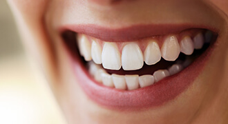 Pretty teeth with cosmetic bonding treatment