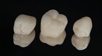 three dental crowns against black background