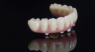 Implant dentures in Tyler