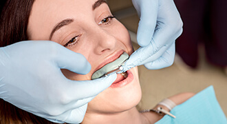 Tyler dental patient getting fitted for bruxism nightguard