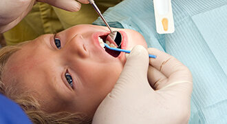 Child receiving fluoride treatment at Tyler dental office