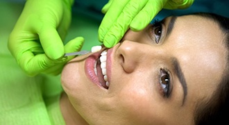 dentist placing veneers in woman’s smile 